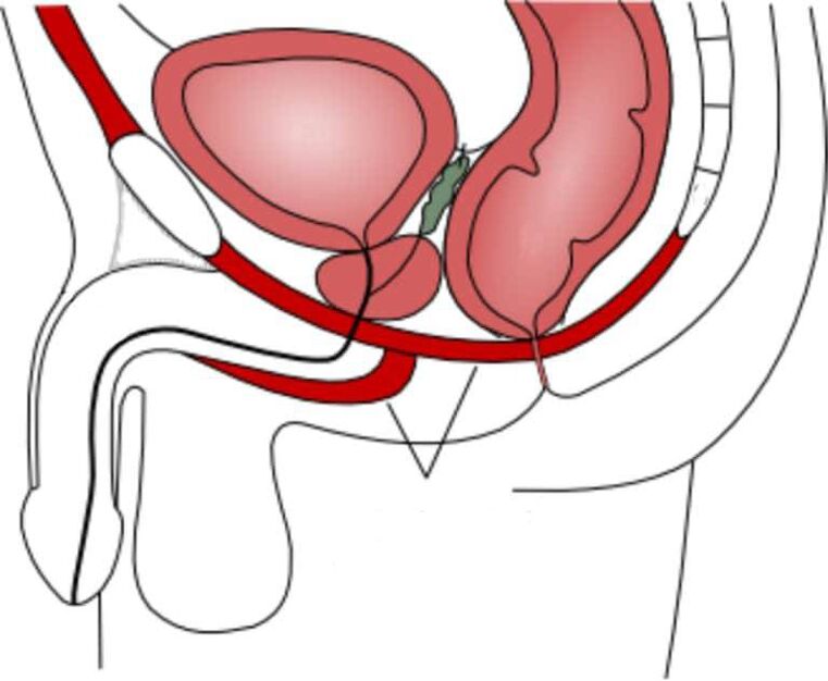 train pelvic floor muscles to improve power